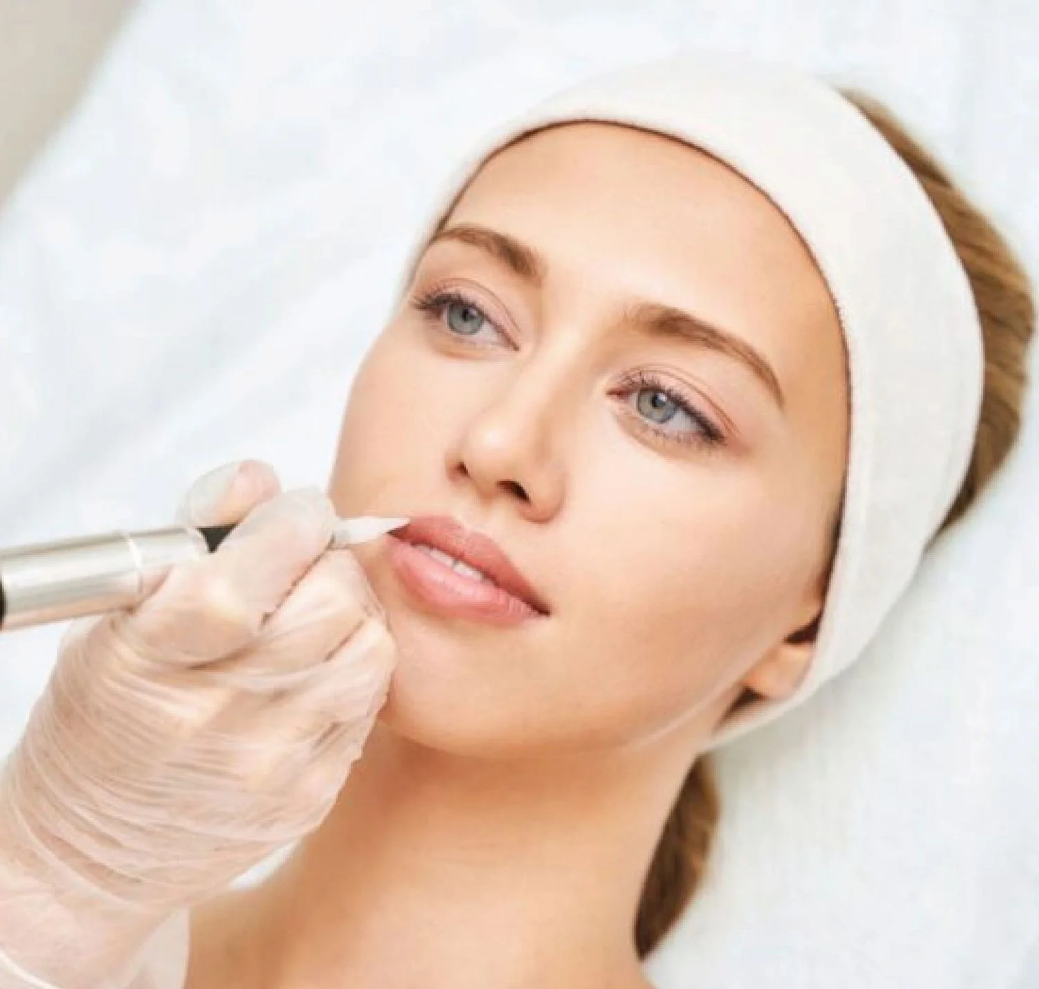 Lip Pigmentation Removal